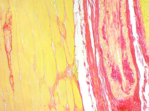 Trichrome Stain AB Solution